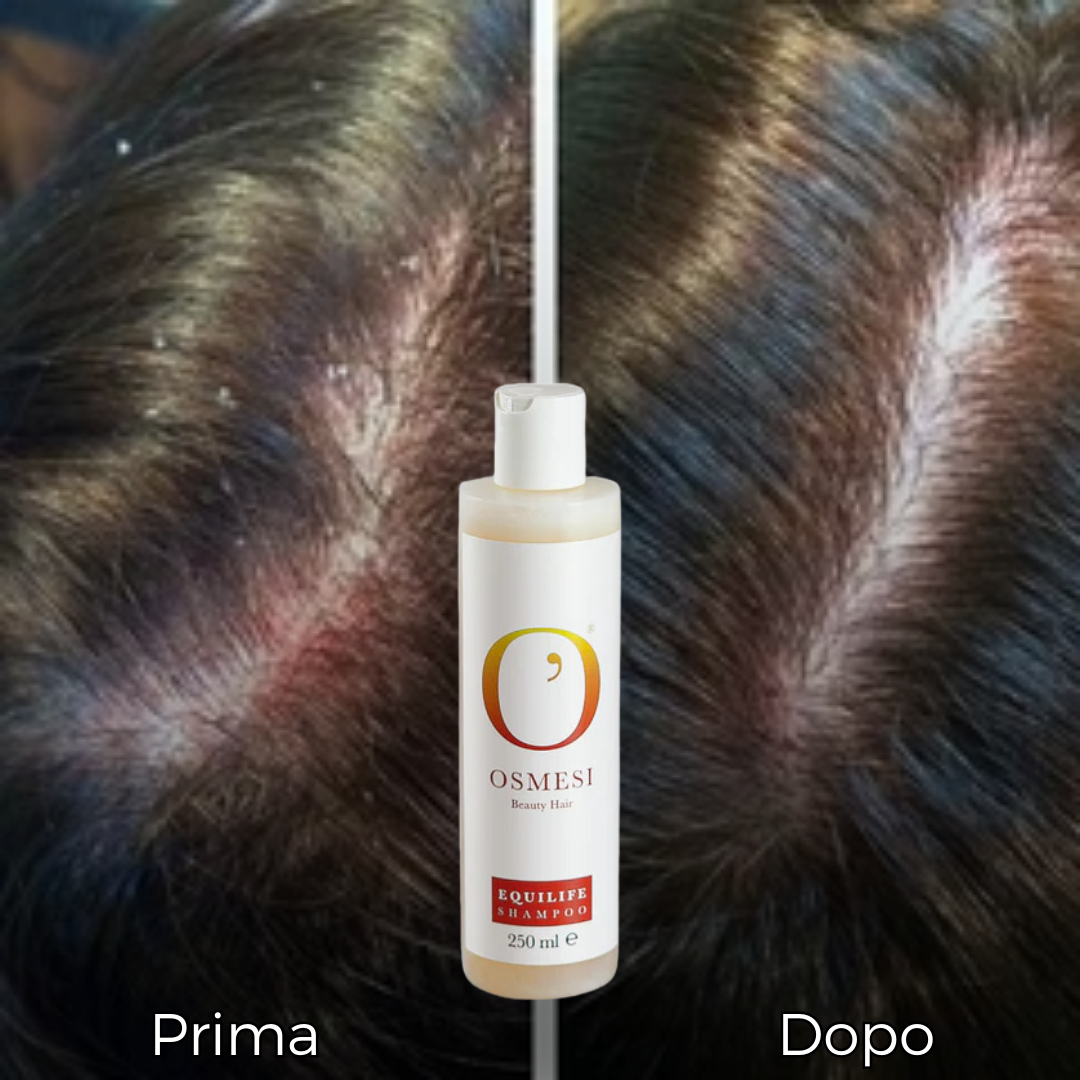 Shampoo Equilife 250 ml - Antiforfora